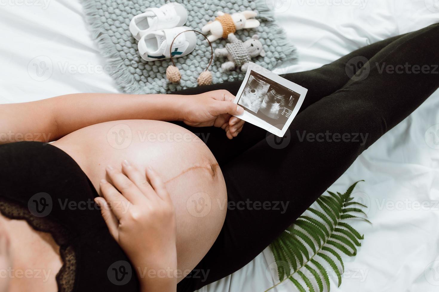 gravid kvinna händer som håller på magen gör en ta hand och kärlek symbol på sovrummet med ultraljudsbild. blivande mamma som väntar och förbereder sig för bebisfödsel. gravid kvinna koncept. foto