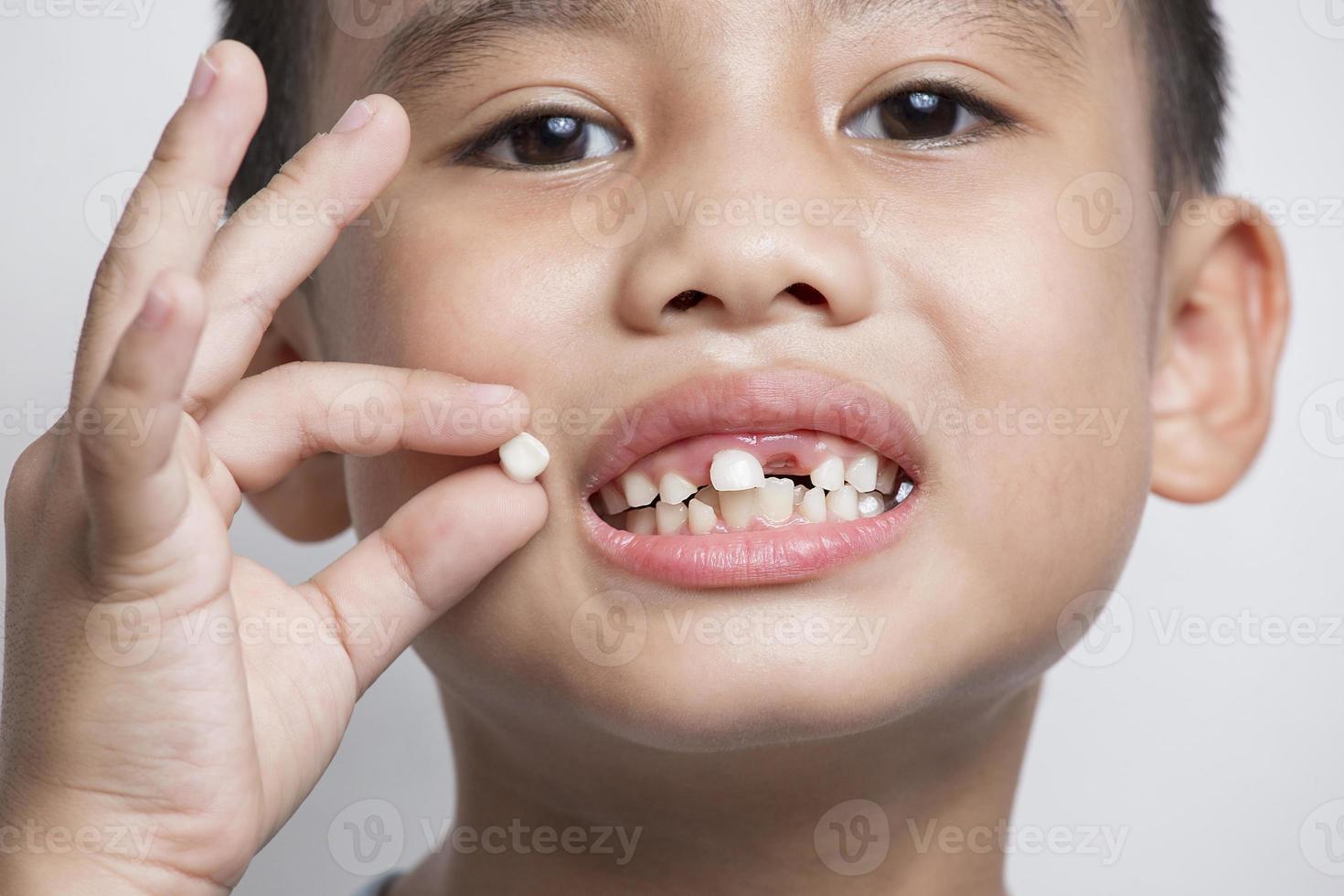 stänga upp ansikte bebis asiatisk håll som visar öppen mun tillfällig förlorat tand tänder mjölk tand foto
