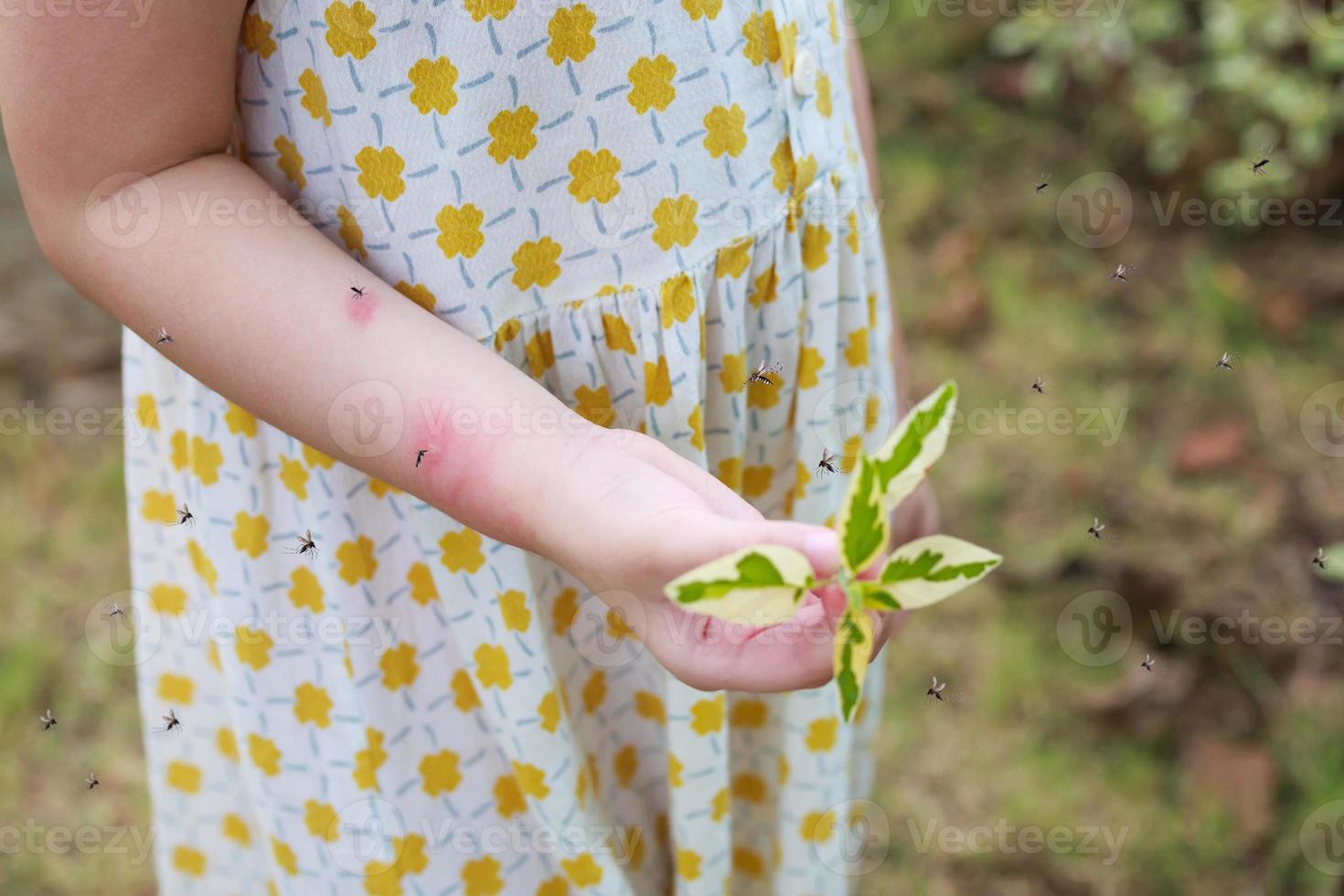 liten flicka har hud utslag allergi klåda och kliar sig på henne ärm med mygg bita foto