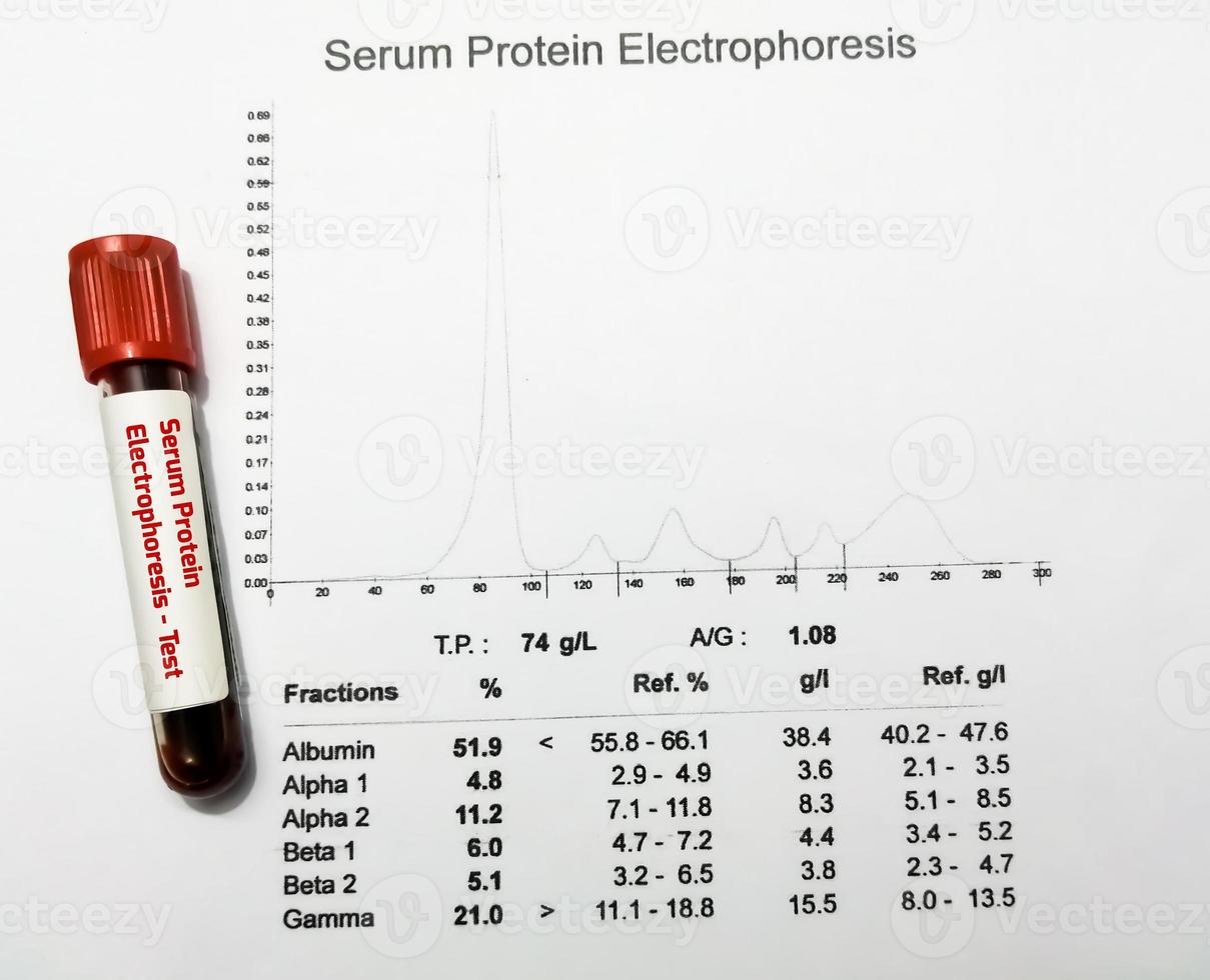 blod prov och patientens Rapportera isolerat för protein elektrofores testa. stänga upp. foto