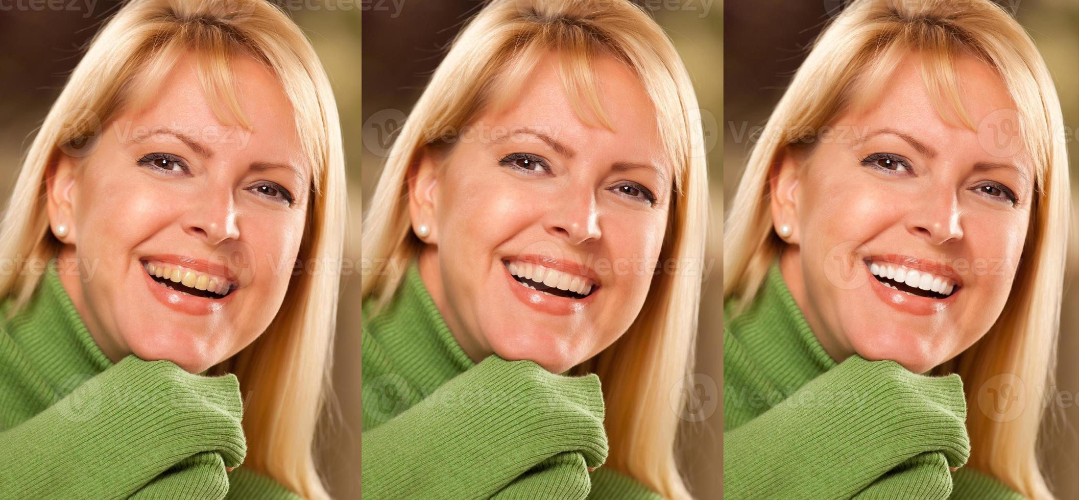 leende kvinna som visar progressiv tänder blekning och blekning. foto