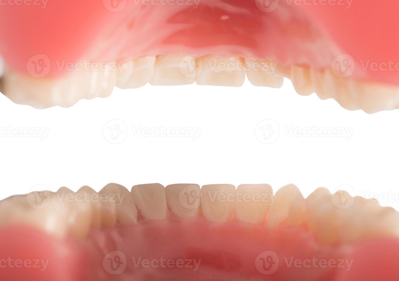 isolerat tänder och tandkött se foto
