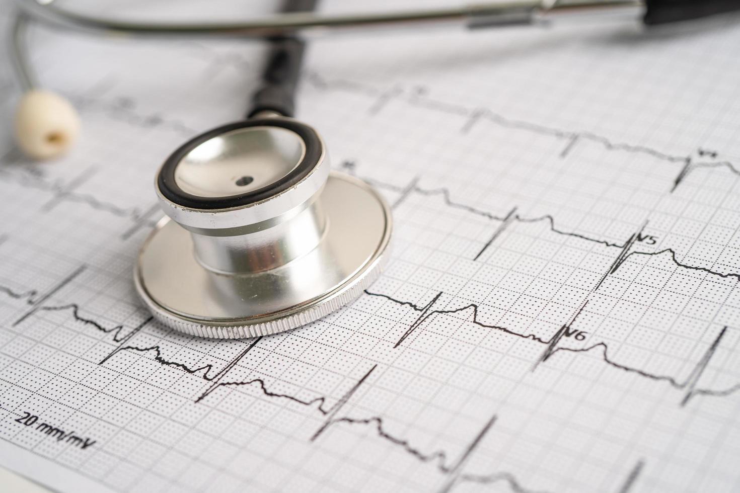 stetoskop på elektrokardiogram -ekg, hjärtvåg, hjärtinfarkt, kardiogramrapport. foto