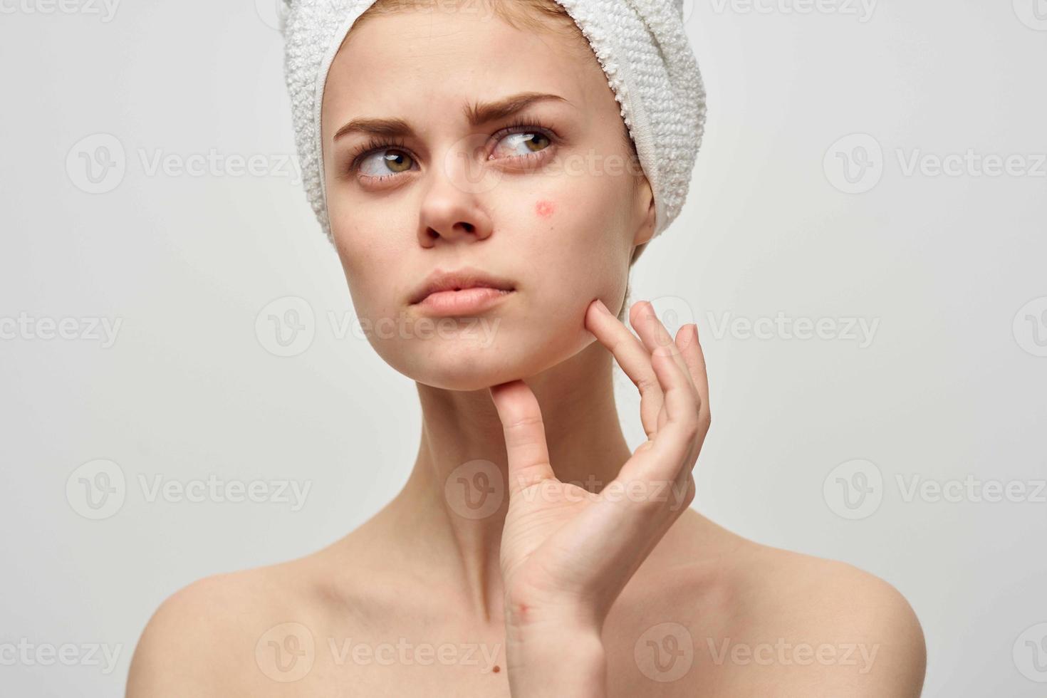 Söt kvinna med en handduk på min huvud dermatologi isolerat bakgrund foto
