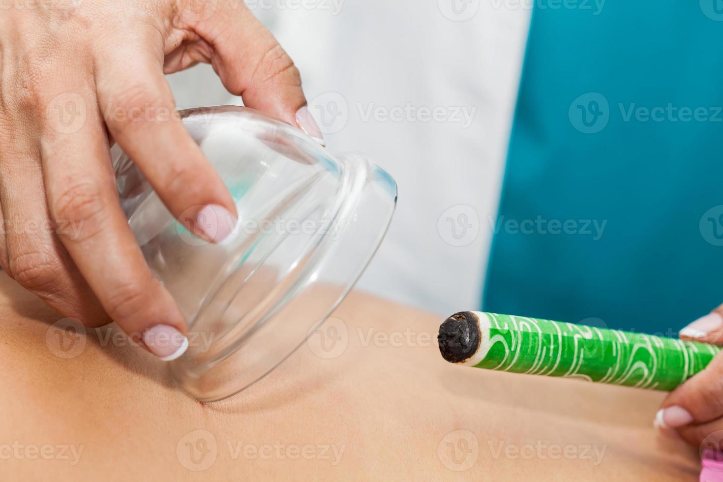 läkare utför en moxibustion terapi på en ung kvinna patient tillbaka foto