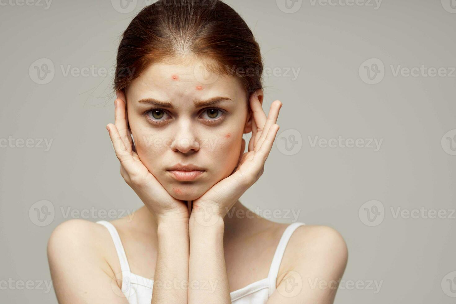 skön kvinna ansiktsbehandling hud problem dermatologi isolerat bakgrund foto