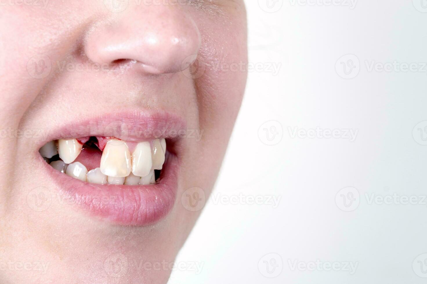 kvinna dental problem foto