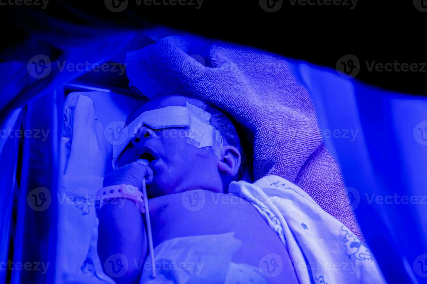 närbild sjuk nyfödd bebis sovande på bebis säng med ultraviolett lampor av fototerapi enhet för behandling nyfödda hyperbilirubinemi foto