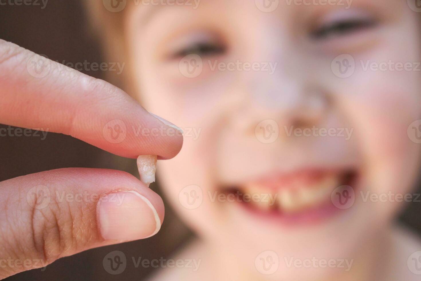 de flicka är innehav de tand i hans hand. foto