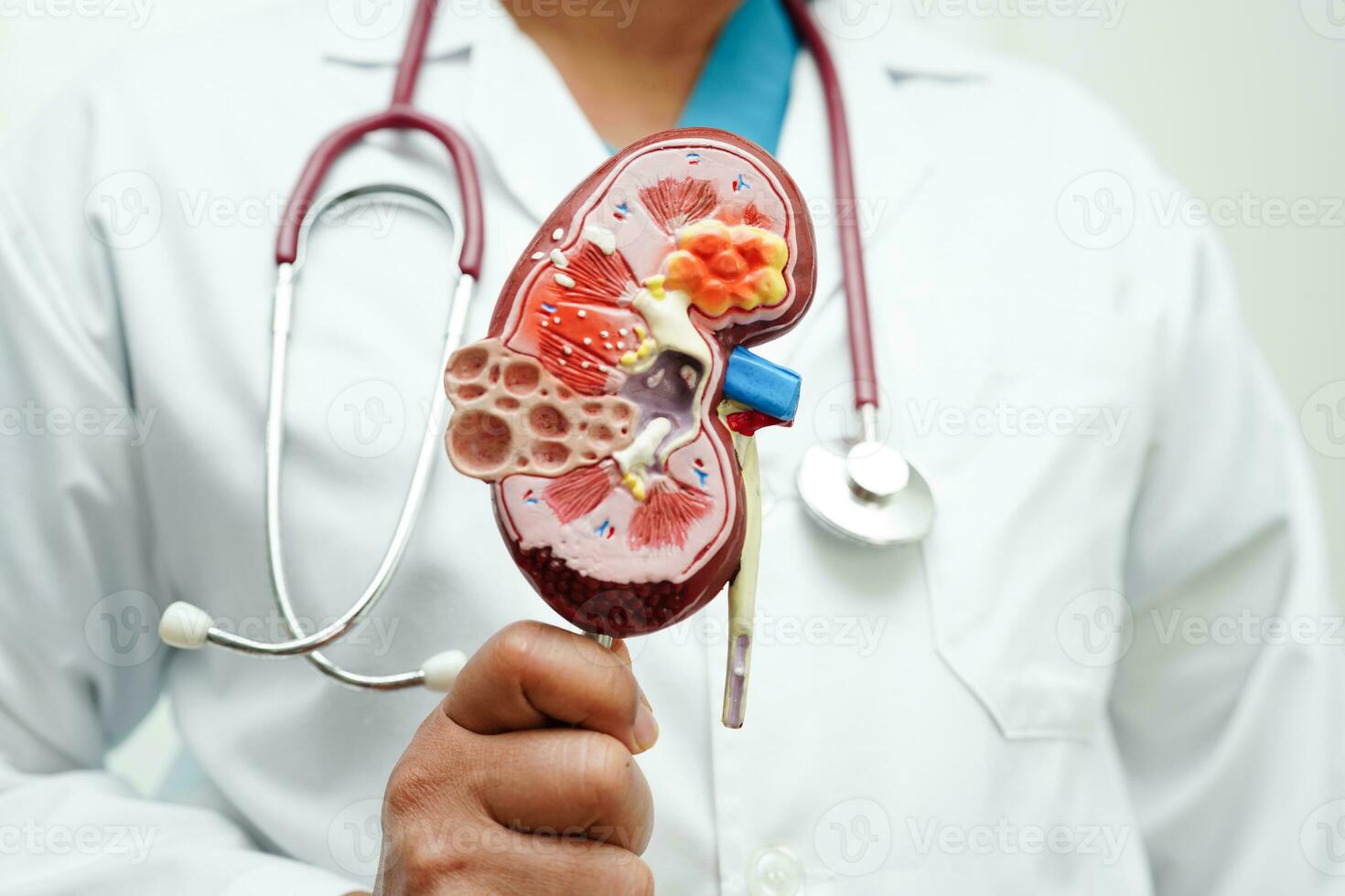 kronisk njure sjukdom, läkare innehav modell för behandling urin- systemet, urologi, beräknad glomerulär filtrering Betygsätta egfr. foto