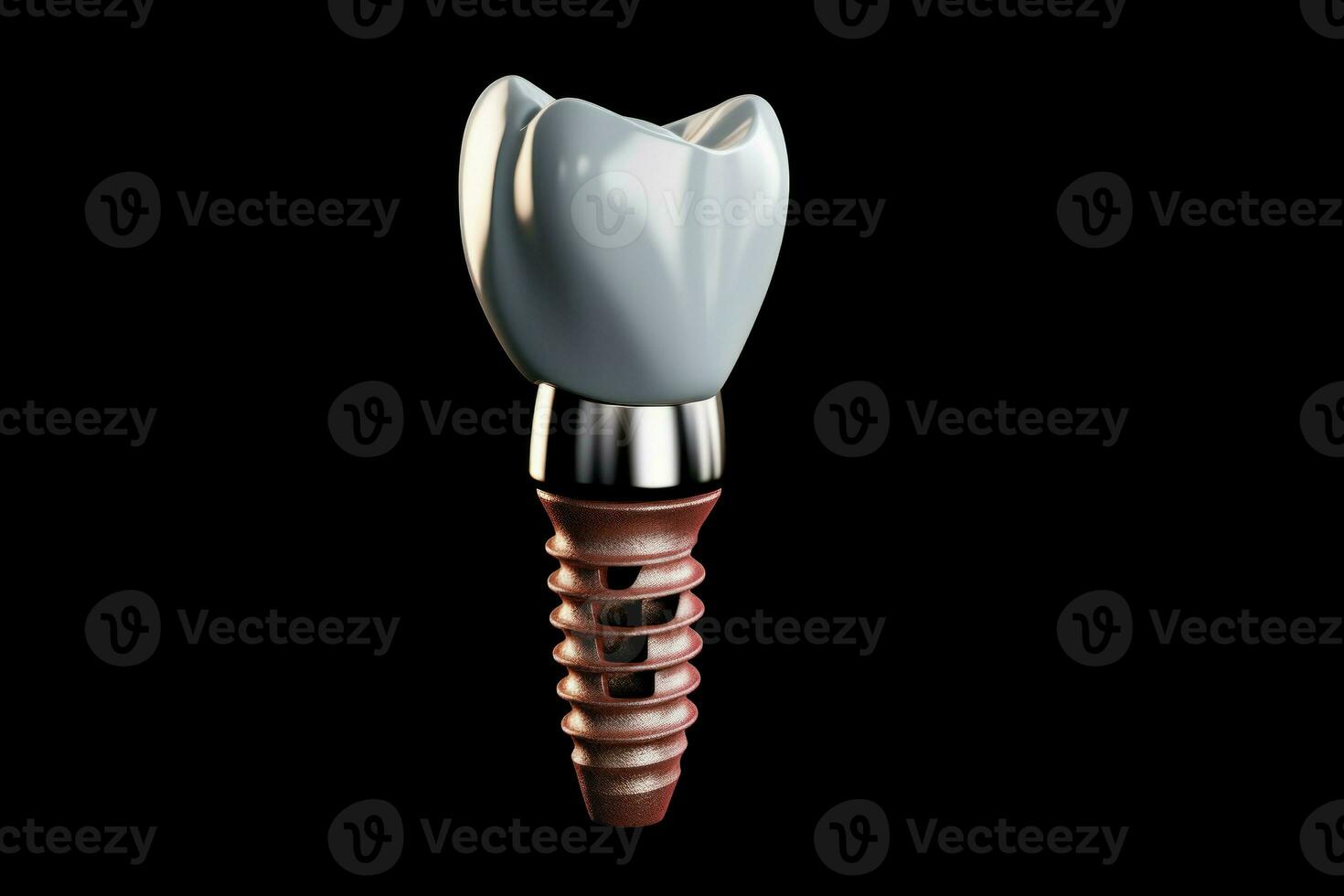 dental implantera hålighet. generera ai foto