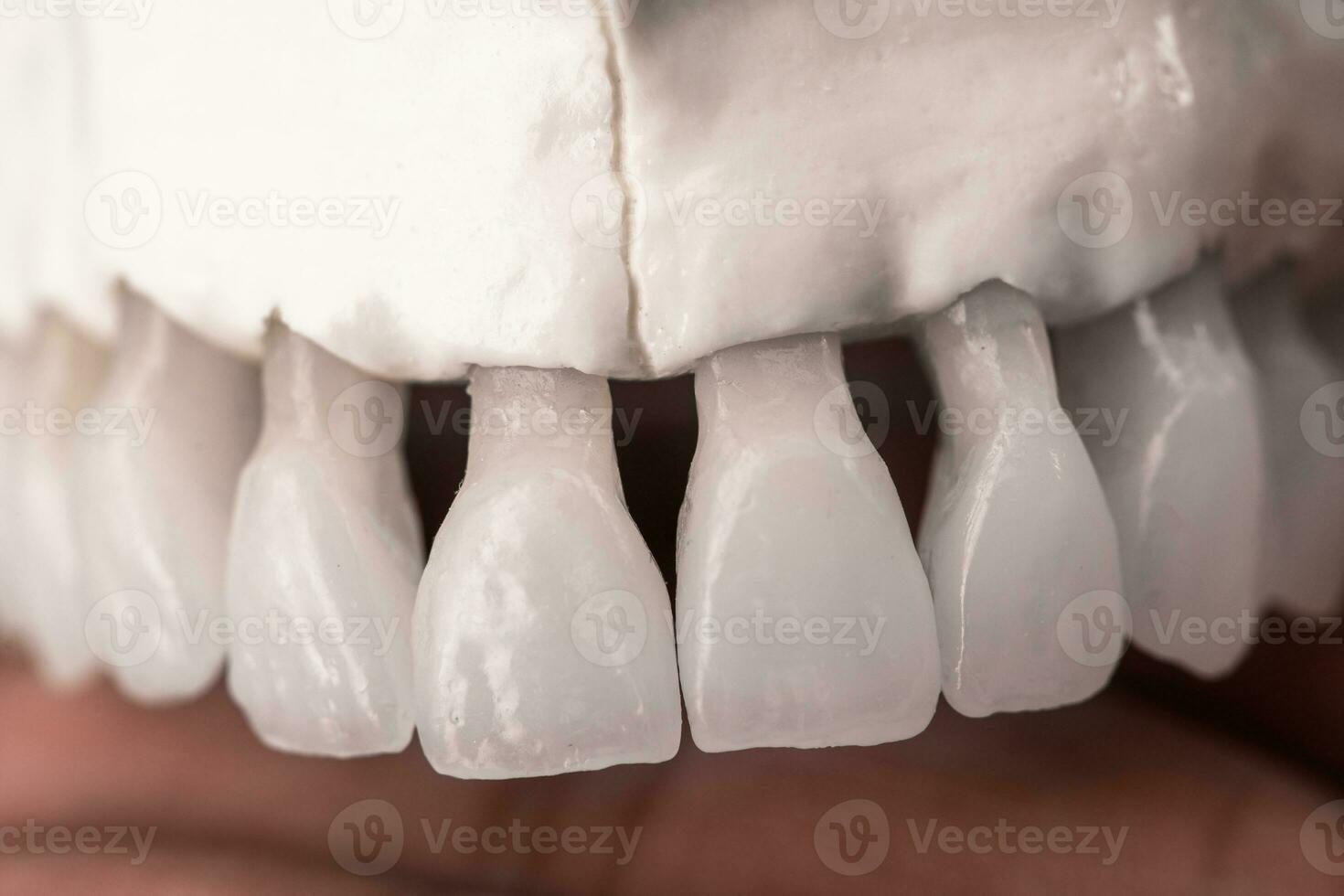 övre mänsklig käke med tänder anatomi modell isolerat på blå bakgrund. friska tänder, dental vård och ortodontisk medicinsk begrepp. foto