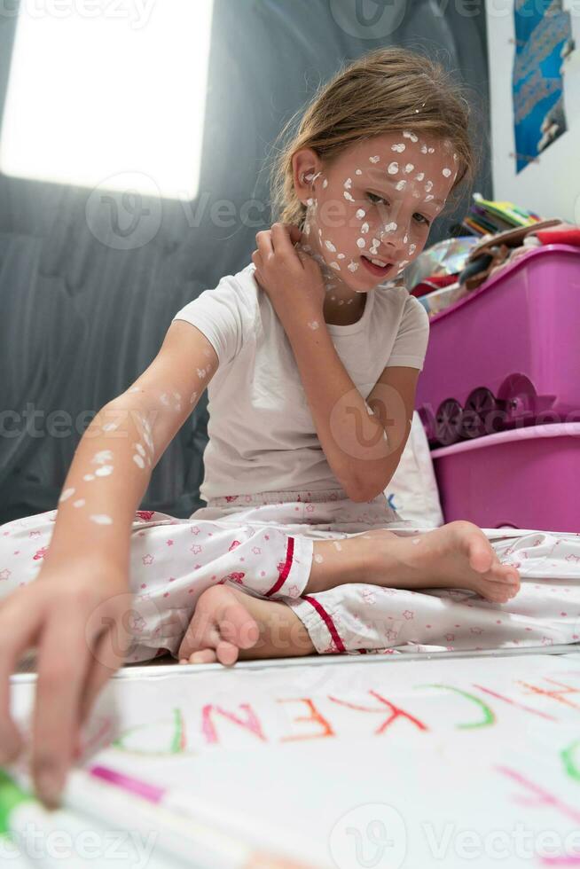 liten skola flicka med vattkoppor teckning på vit styrelse i ungar' rum, antiseptisk grädde applicerad till ansikte och kropp. svarta tavlan och leksaker bakgrund. foto