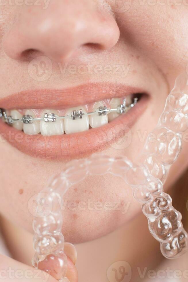 dental omsorg.ler flicka med tandställning på henne tänder innehar inriktare i henne händer och visar de skillnad mellan dem foto