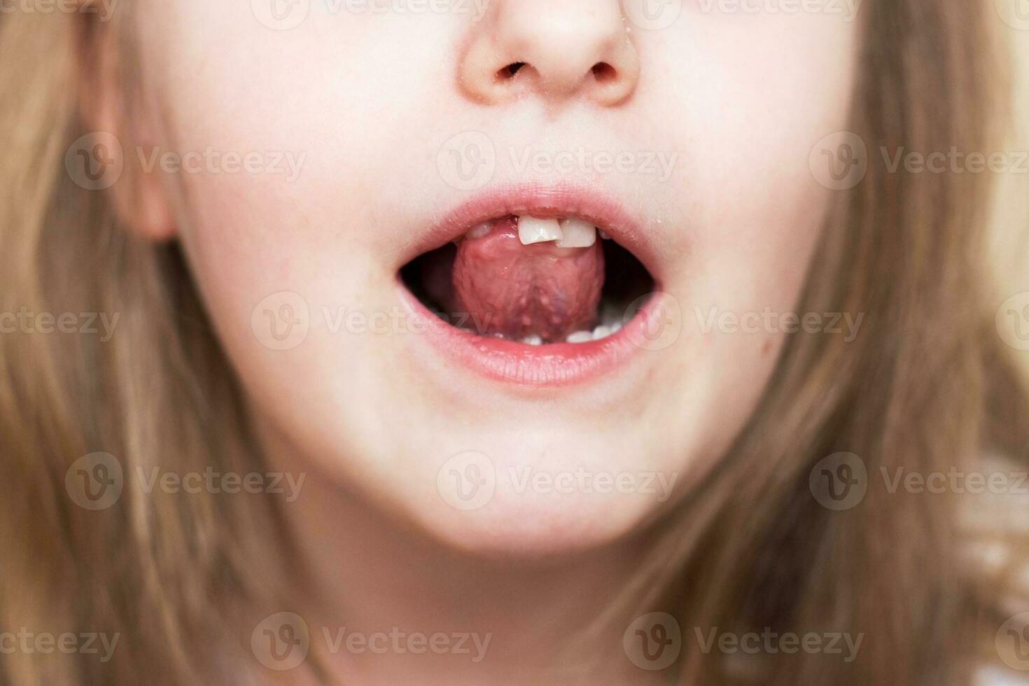 porträtt av en liten barn flicka rör på sig henne mjölk främre tand med henne tunga i öppen mun. foto