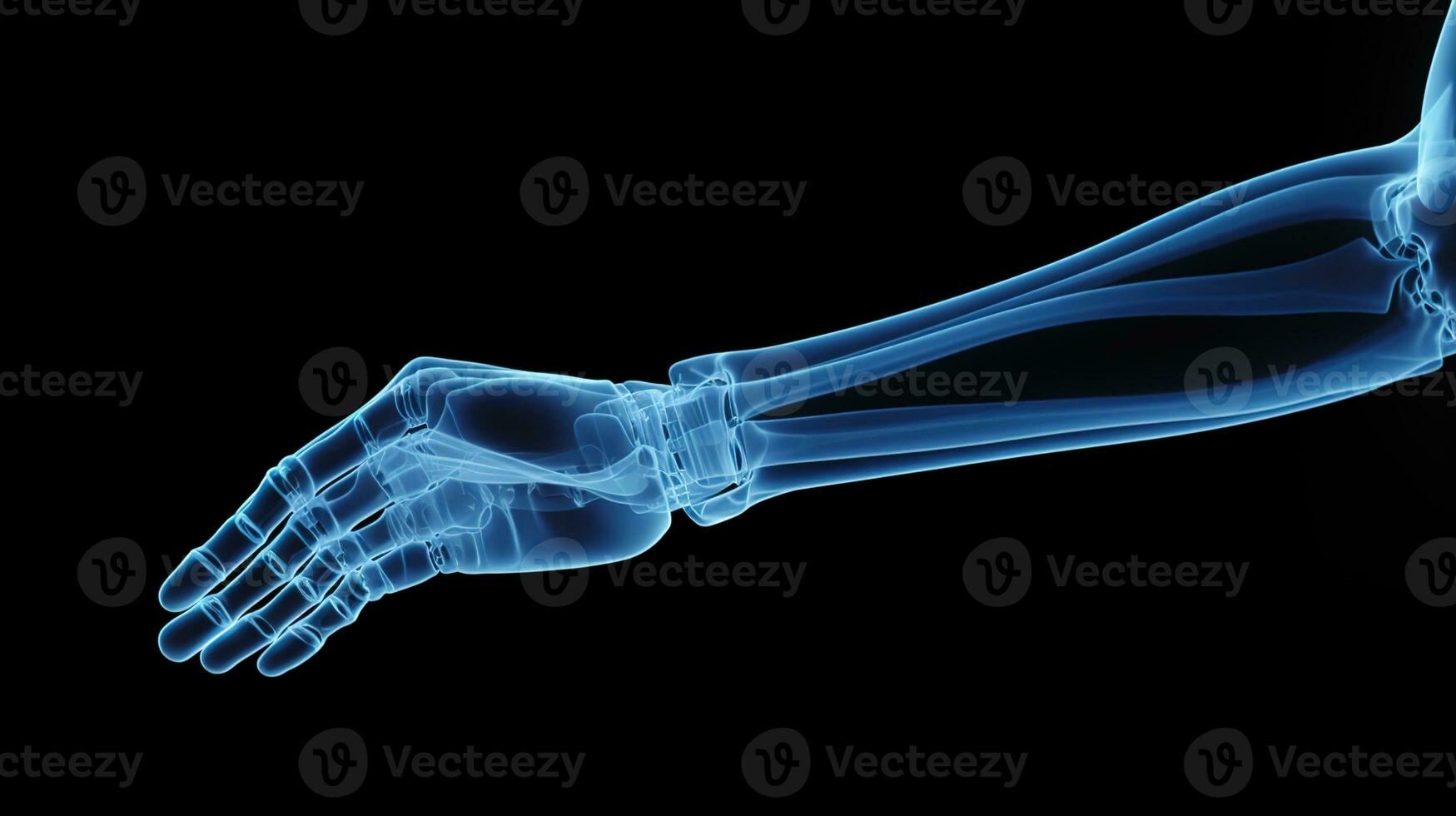 ortopedisk förträfflighet, detaljerad röntgen av en manlig mänsklig ärm i blå toner på en svart bakgrund - idealisk för exakt medicinsk avbildning och diagnos, ai generativ foto