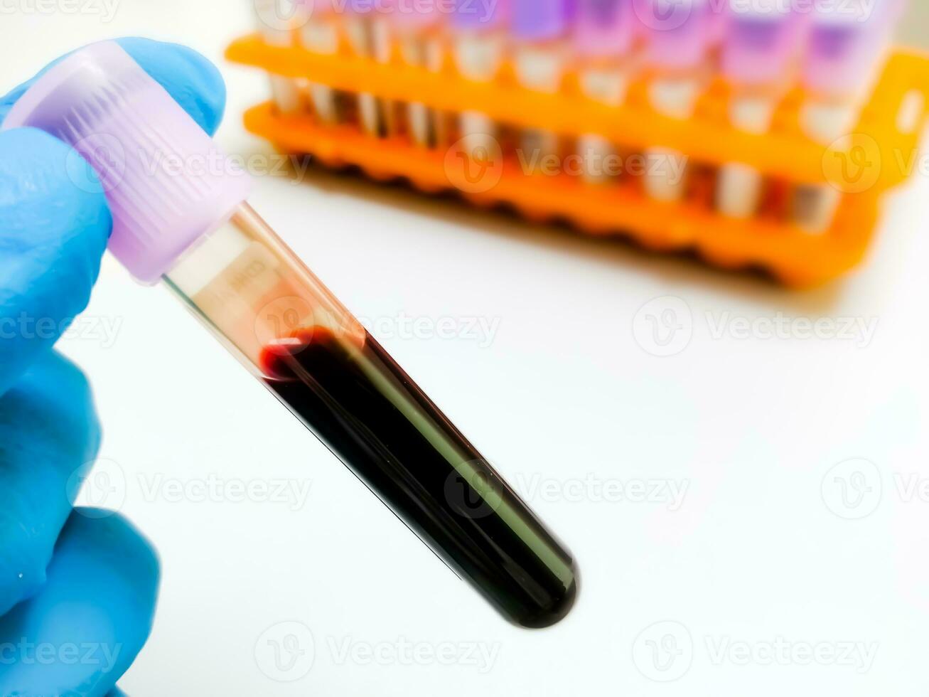 teknolog innehav levender eller hela blod edta rör med blod prov för medicinsk testning i laboratorium. foto