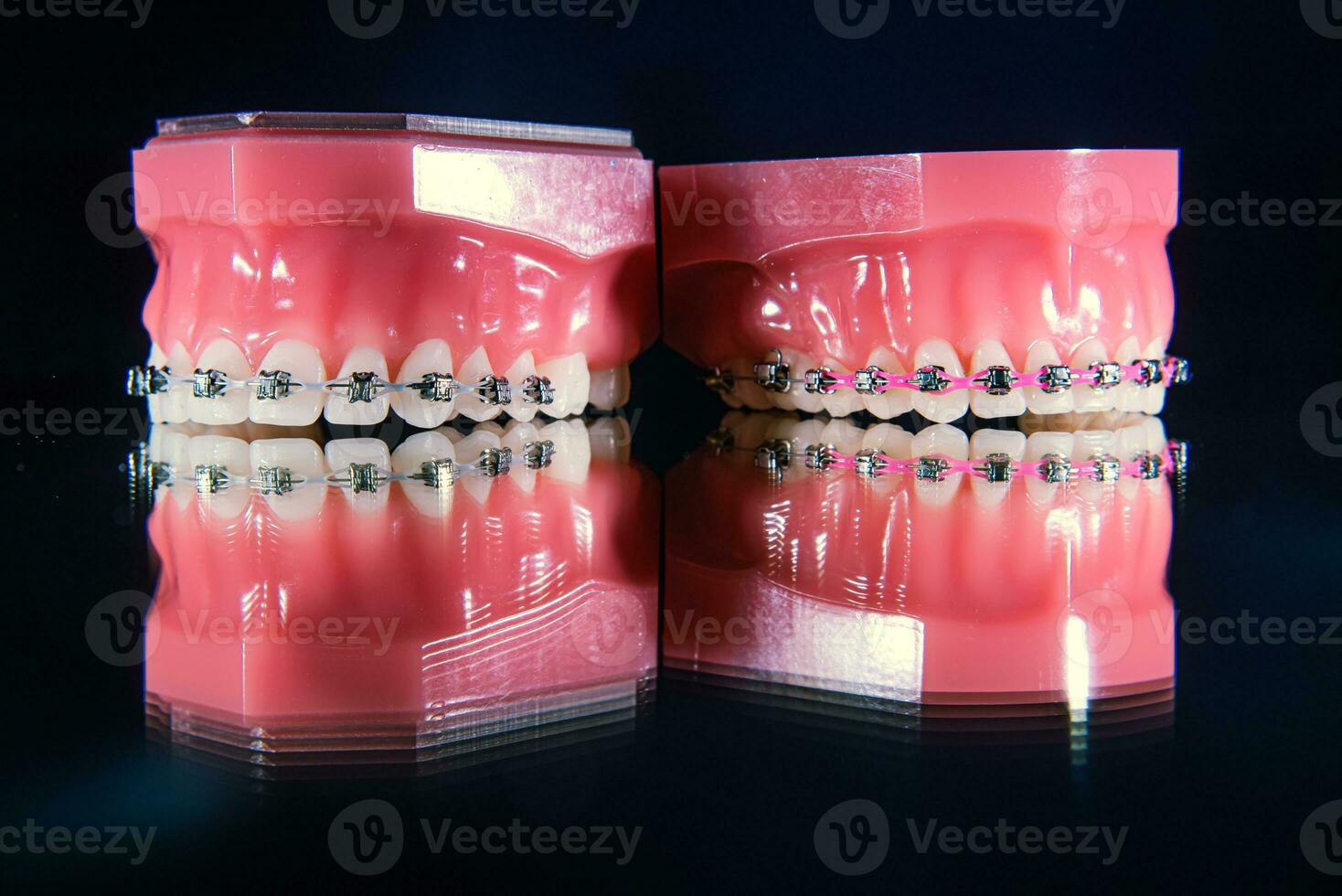 de tandställning är på de tänder i de artificiell käke på en svart bakgrund. närbild foto