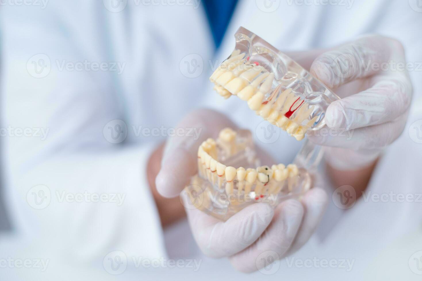 läkare ortodontist visar de instrument på karies i de tänder foto