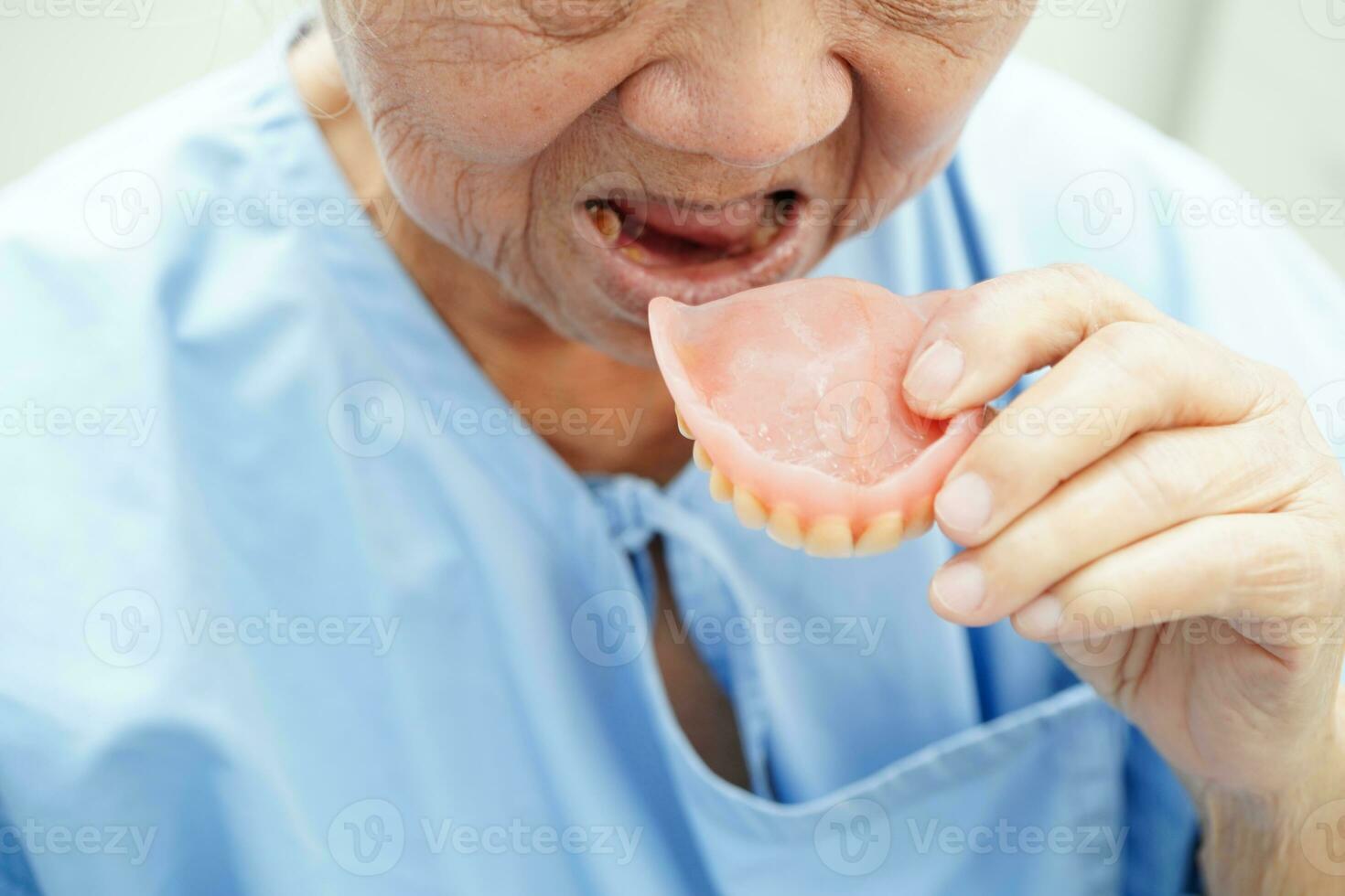 asiatisk senior kvinna patient bär tänder tandprotes in i henne mun för Tugga mat. foto