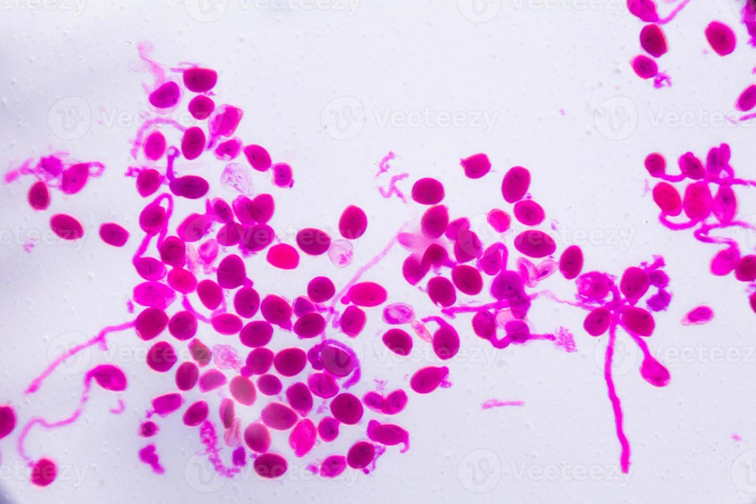 hemerocallis citrina mogen anther under mikroskopet - abstrakta rosa prickar på vit bakgrund foto