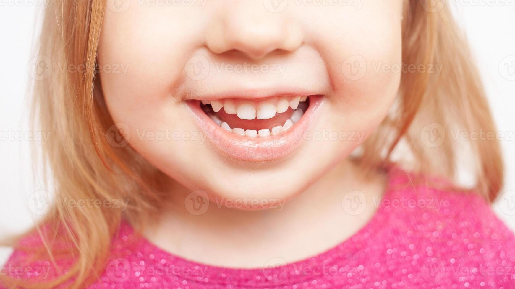 flicka barn leende, vit tänder efter pensling och blekning, barndom och dental vård foto