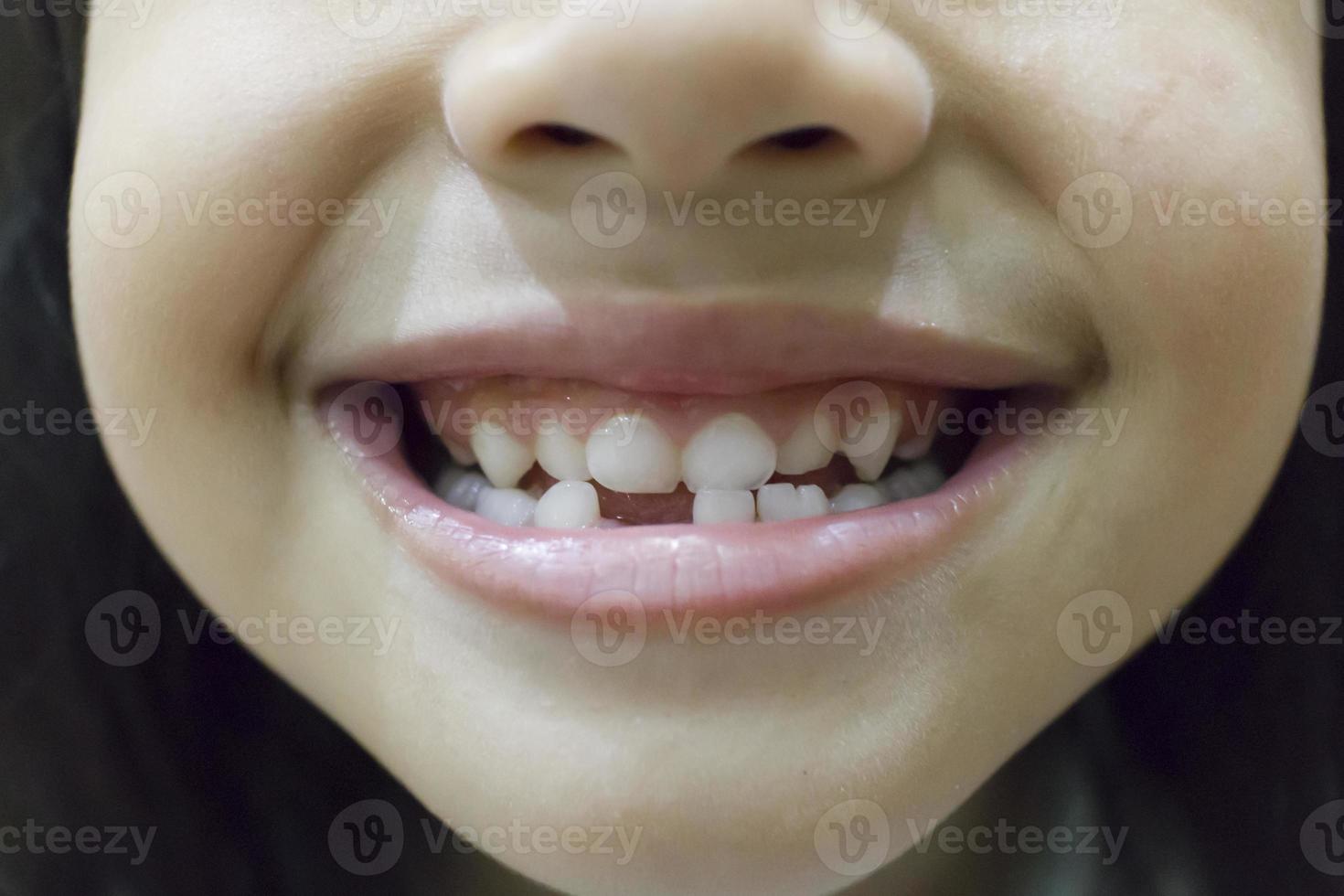 liten flicka leende förlora sin första tand foto