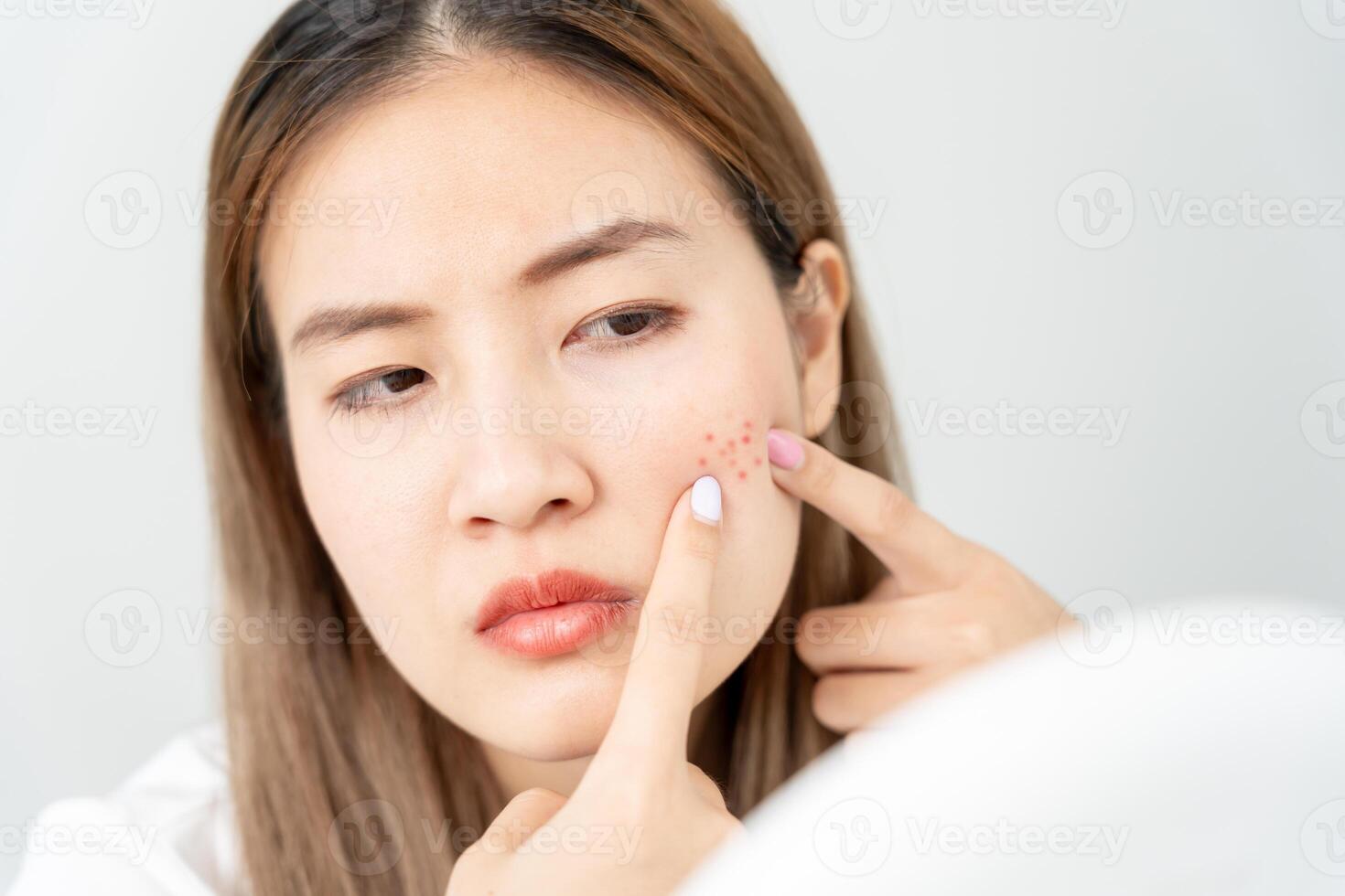 ung kvinna är orolig handla om ansikten dermatologi och allergisk till steroider i kosmetika. känslig hud, röd ansikte från solbränna, acne, allergisk till kemikalier, utslag på ansikte. hud problem och skönhet foto