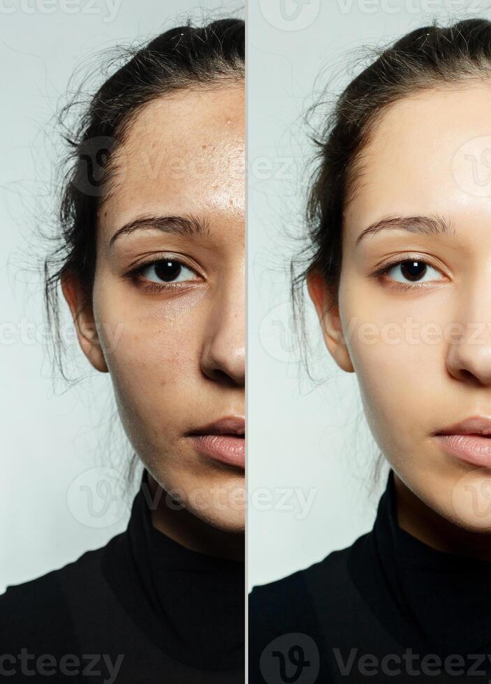 innan och efter kosmetisk drift. foto