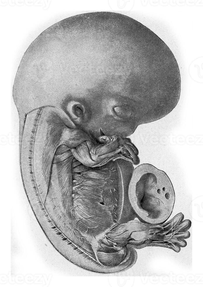 mänsklig embryo, årgång gravyr. foto