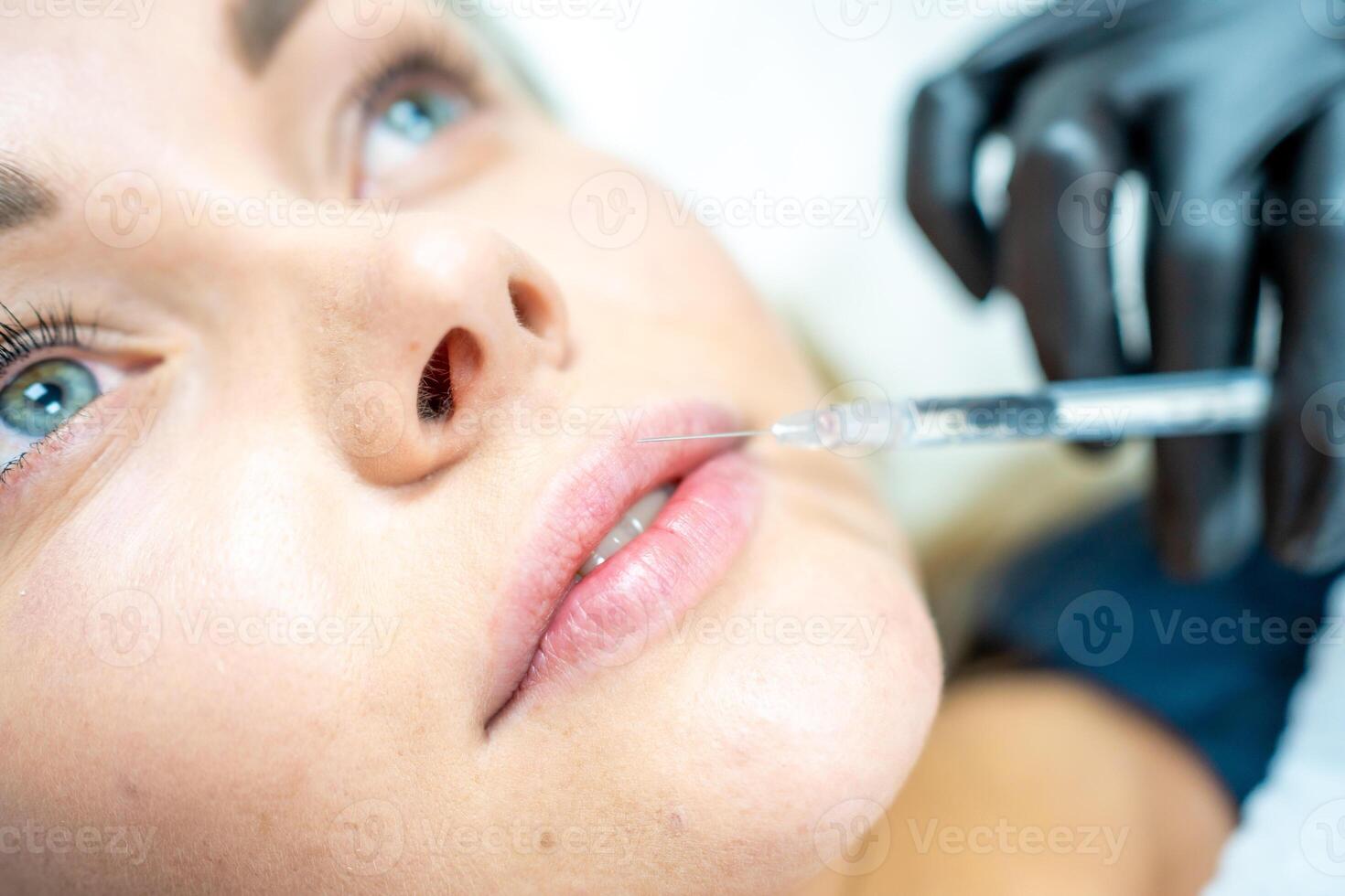 närbild av kvinna ansikte och hand i kirurgisk handske innehav spruta nära henne mun, redo till motta skönhet behandling. injektion kosmetologi, mun förstärkning och korrektion begrepp. foto