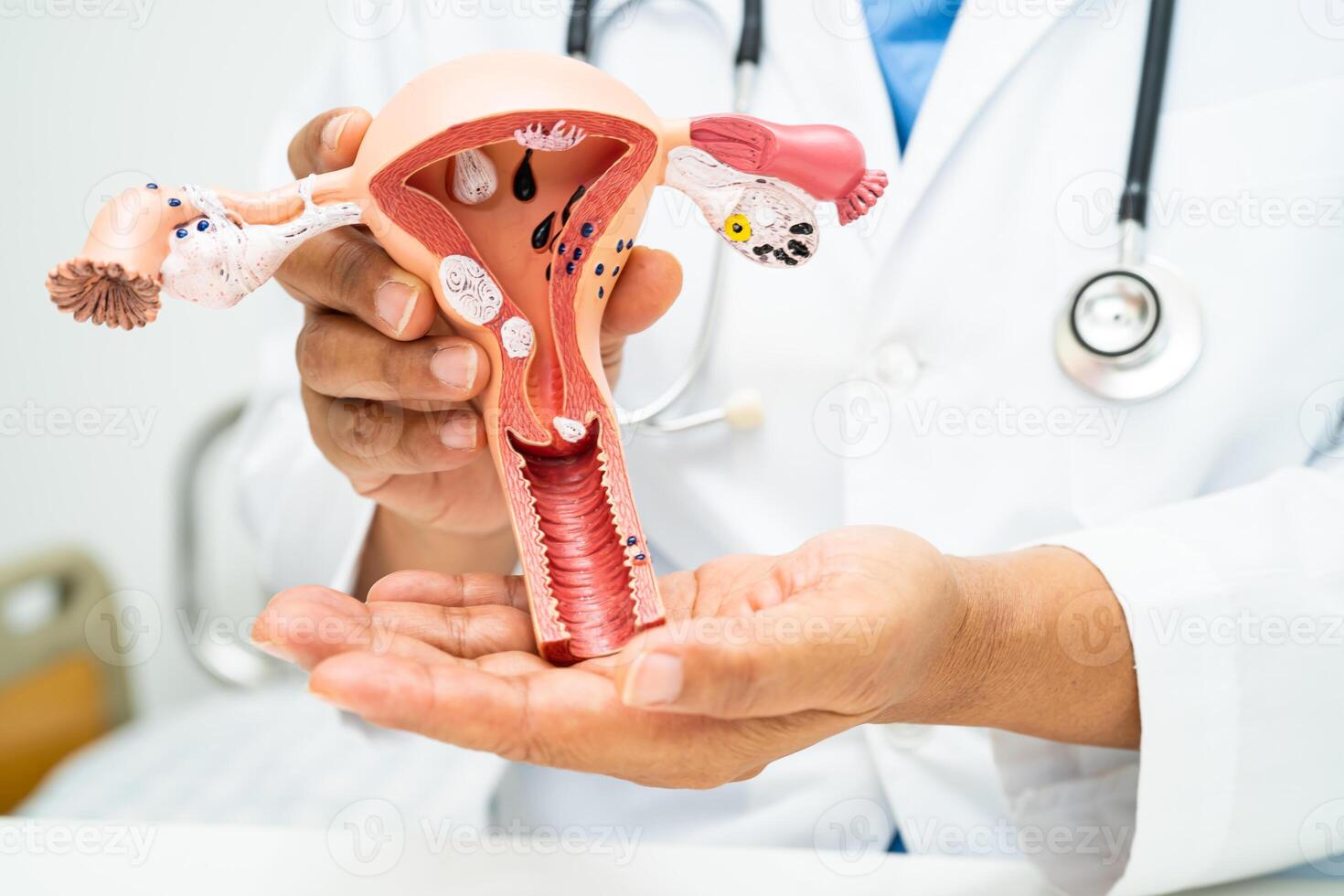 livmoder, läkare med anatomi modell för studie diagnos och behandling i sjukhus. foto