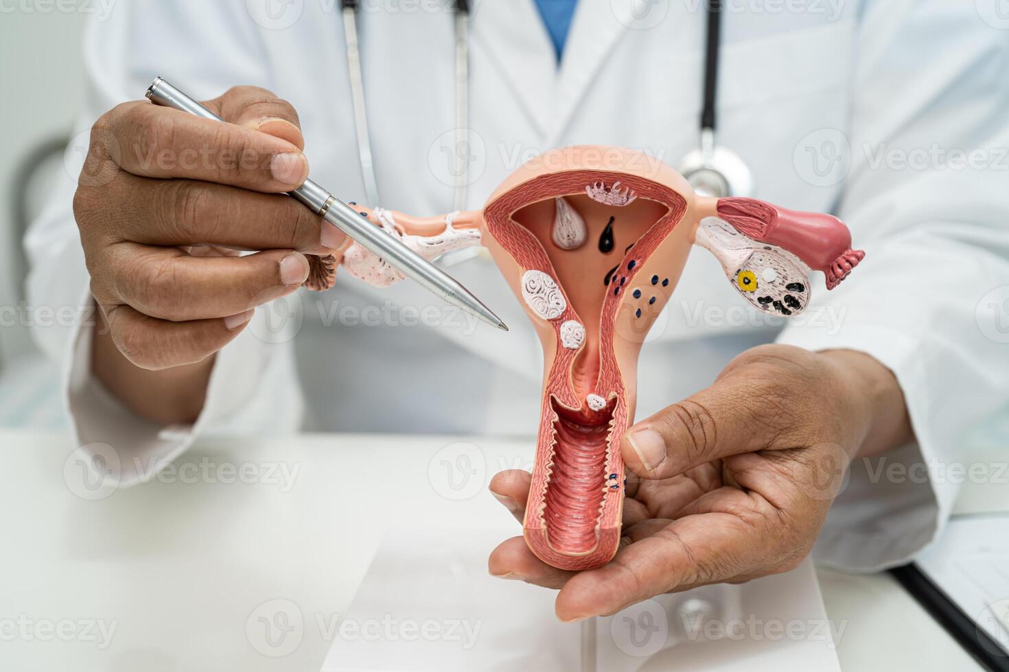 livmoder, läkare med anatomi modell för studie diagnos och behandling i sjukhus. foto