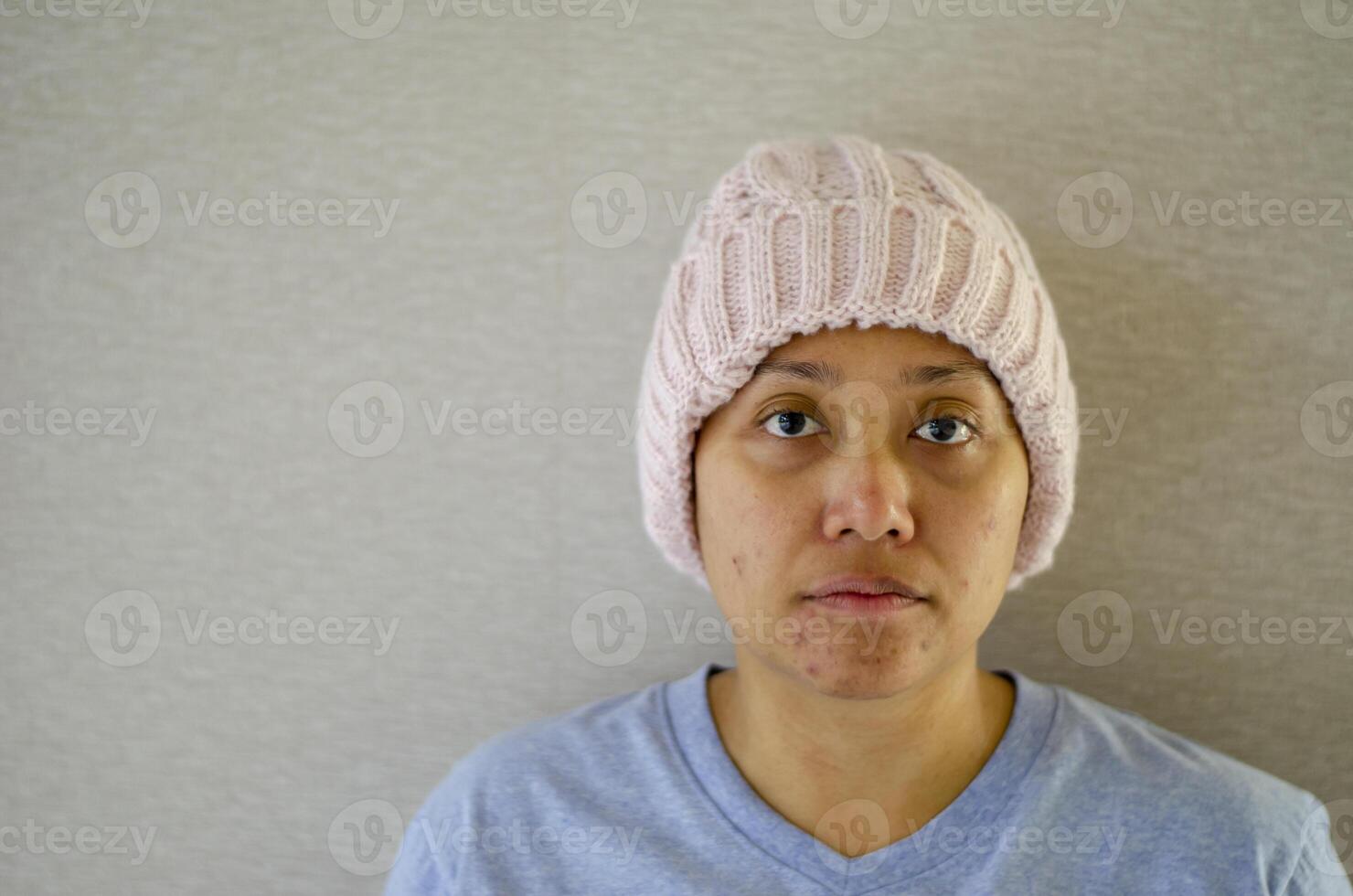asiatisk kvinna med cancer, porträtt foto