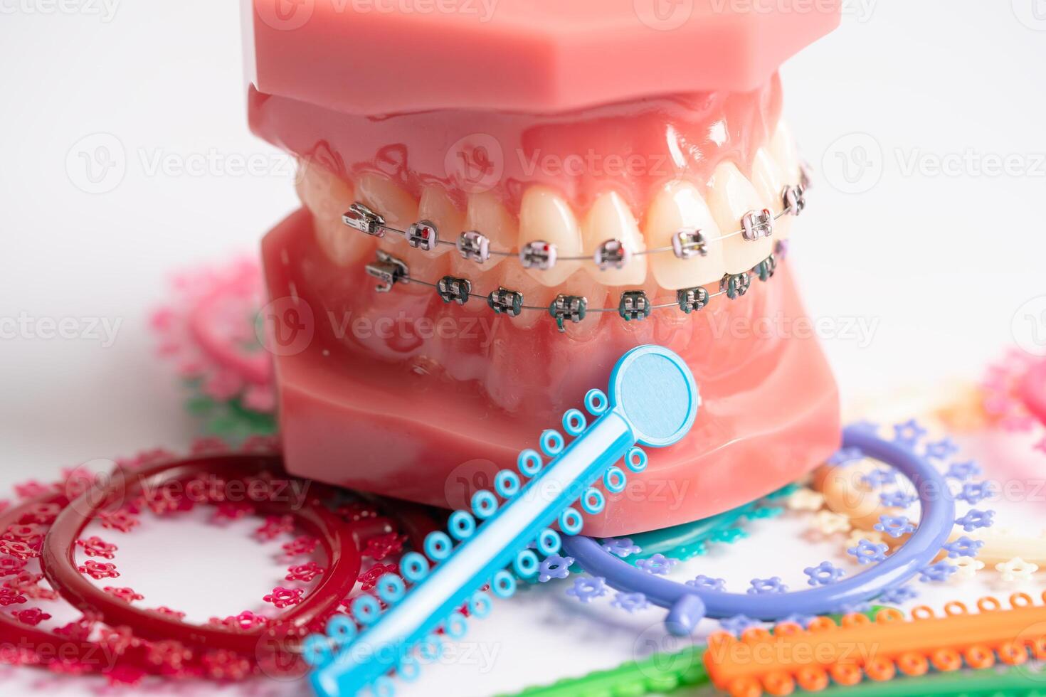 ortodontisk ligaturer ringar och slipsar, elastisk sudd band på ortodontisk tandställning, modell för tandläkare studerar handla om tandvård. foto