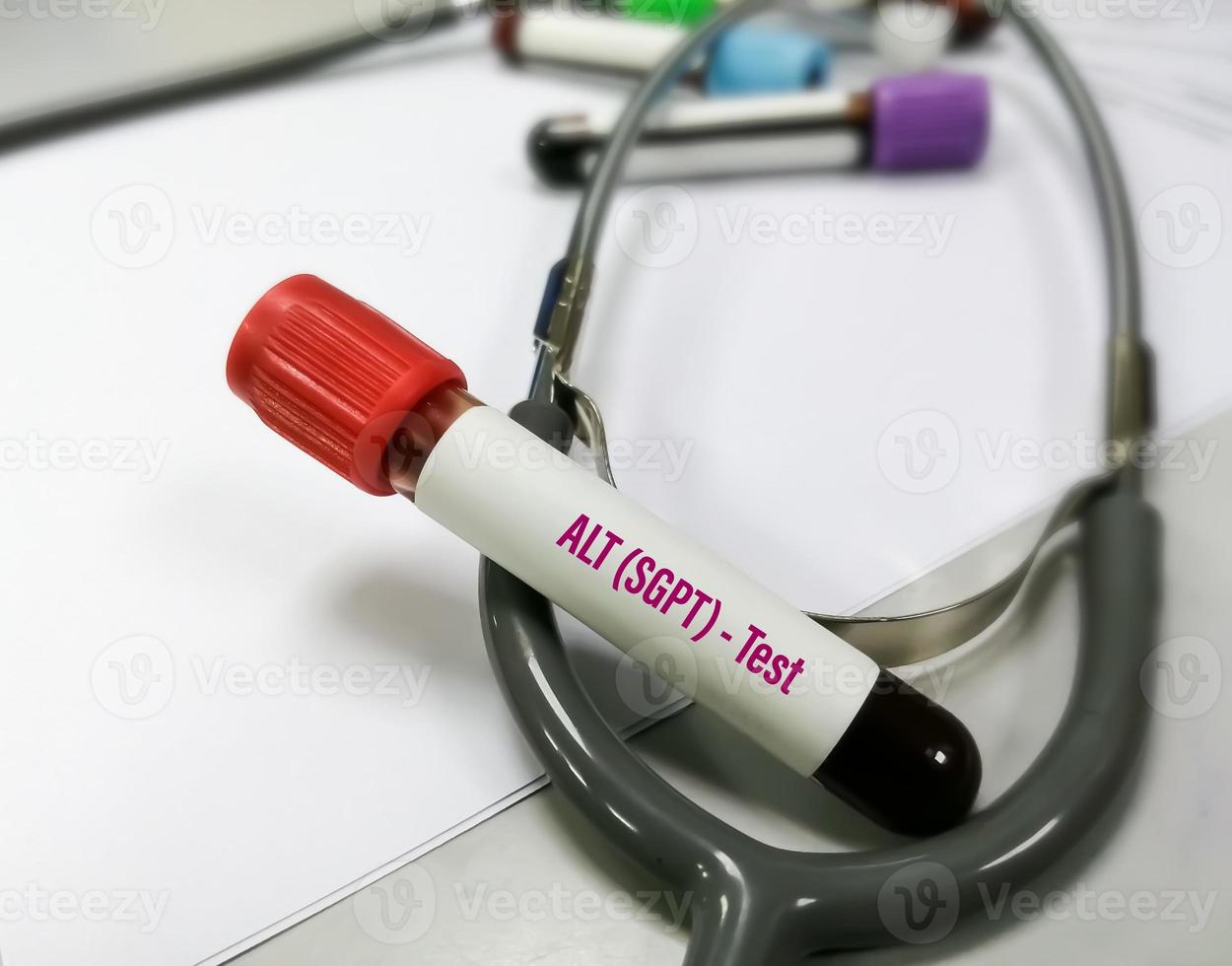 blodprov för serum alt-test. sgpt foto