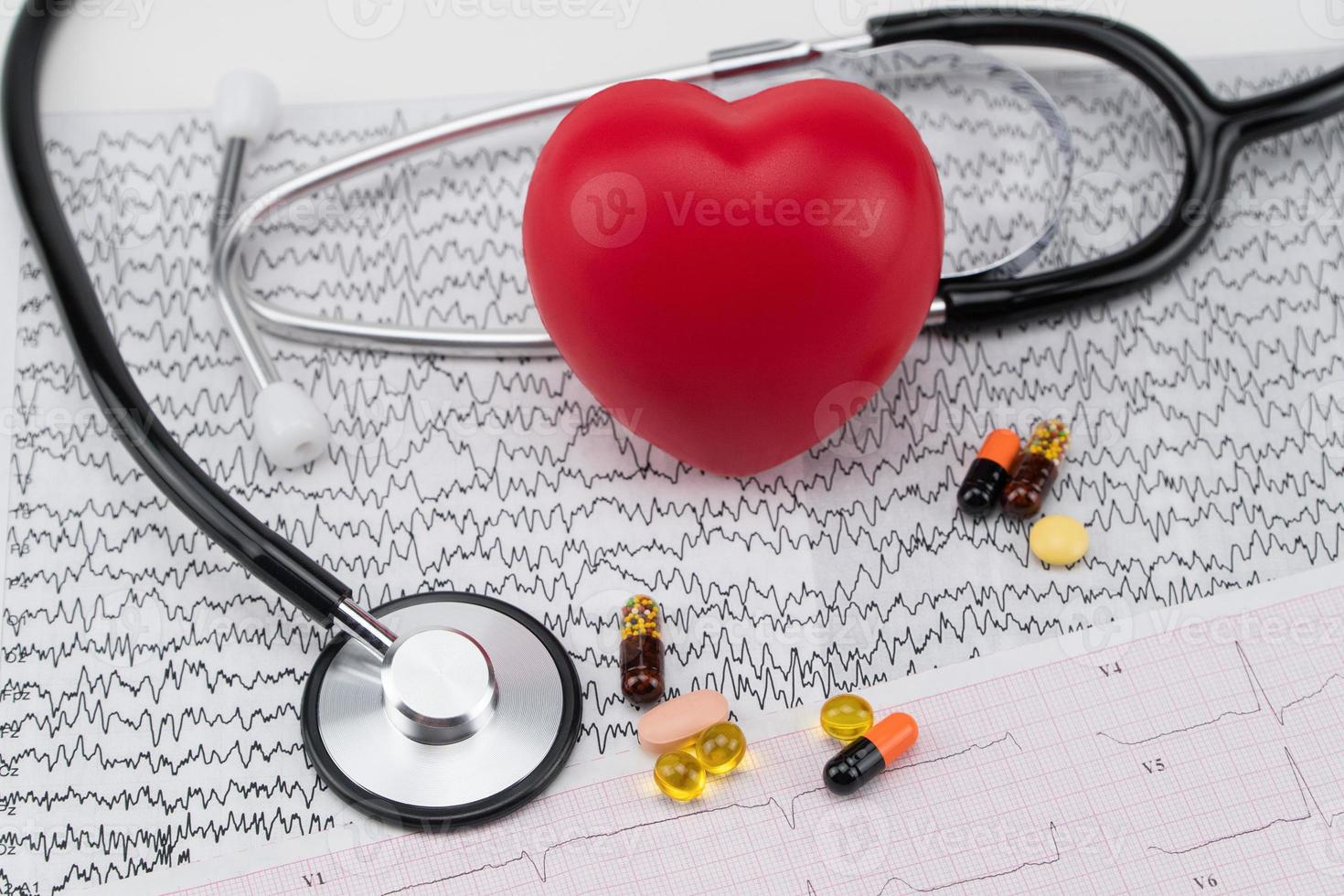 stetoskop på elektrokardiogram och leksakshjärta. koncept sjukvård. kardiologi - vård av hjärtat foto