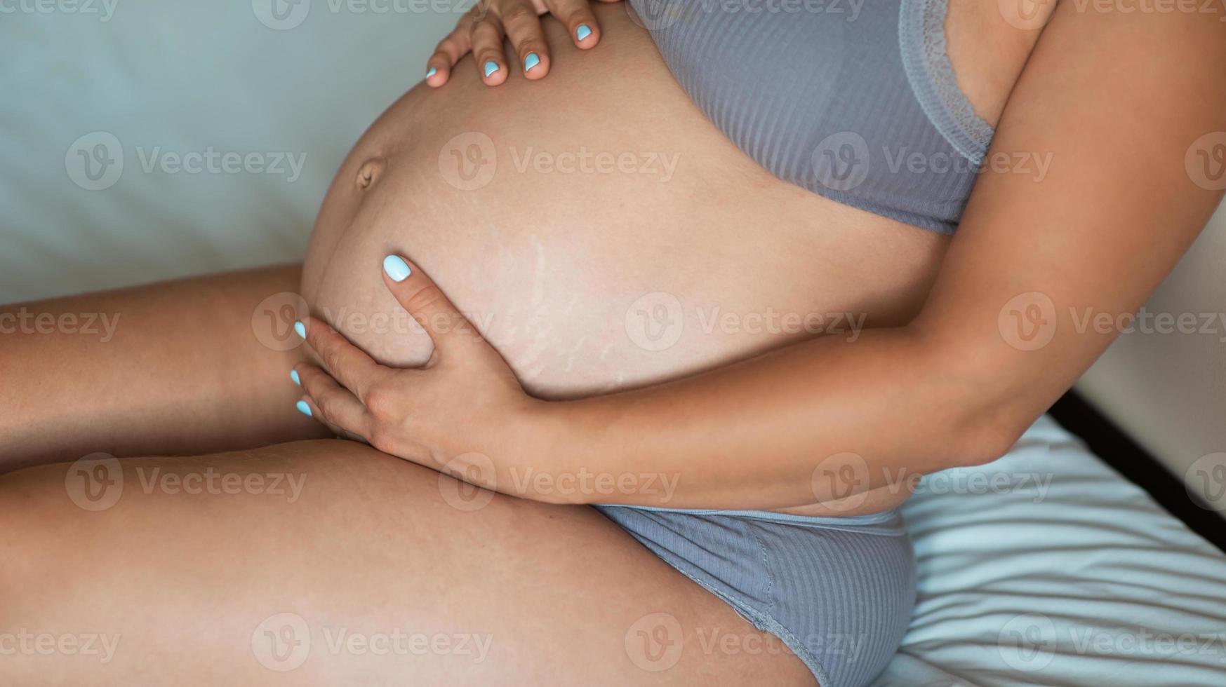 gravid kvinnas mage är närbild. naturlig hudstruktur. skadad hud med sträckningar, ärr, ränder foto