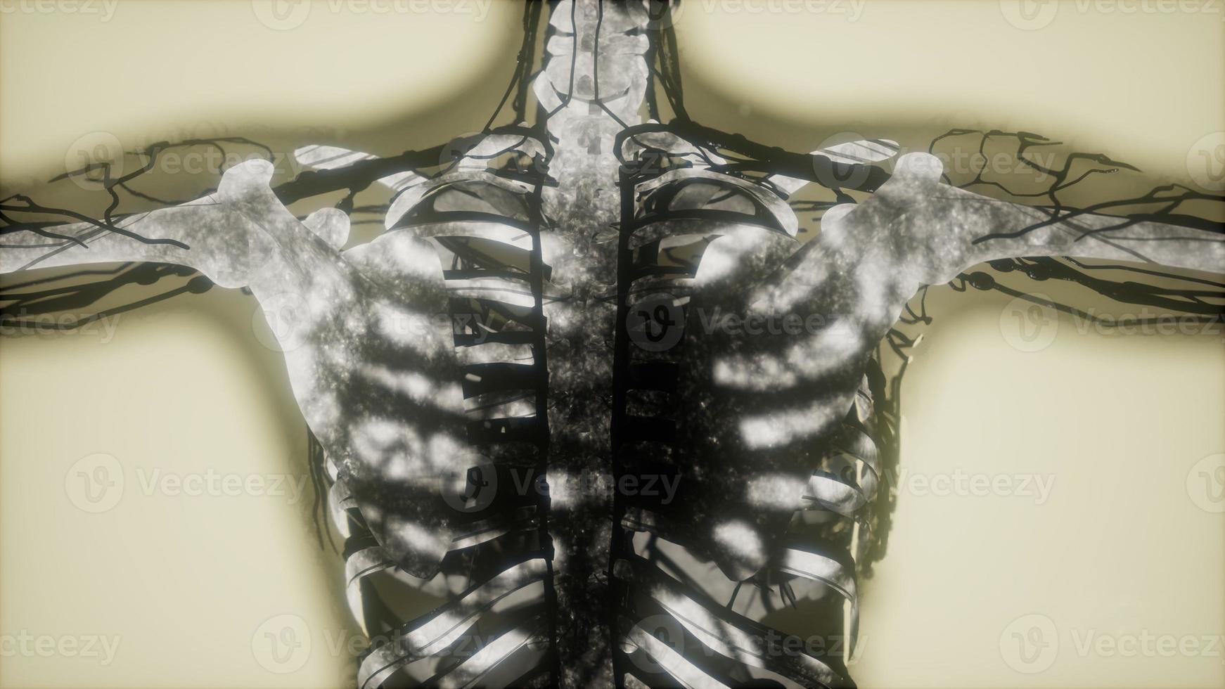 mänskliga skelett ben scan glödande foto