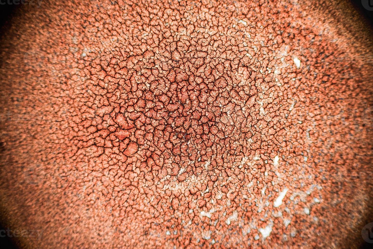 stelnat koagulerat blod sett i en 100x mikroskopvy. blodutstryk under mikroskop presentera neutrofiler och röda blodkroppar foto