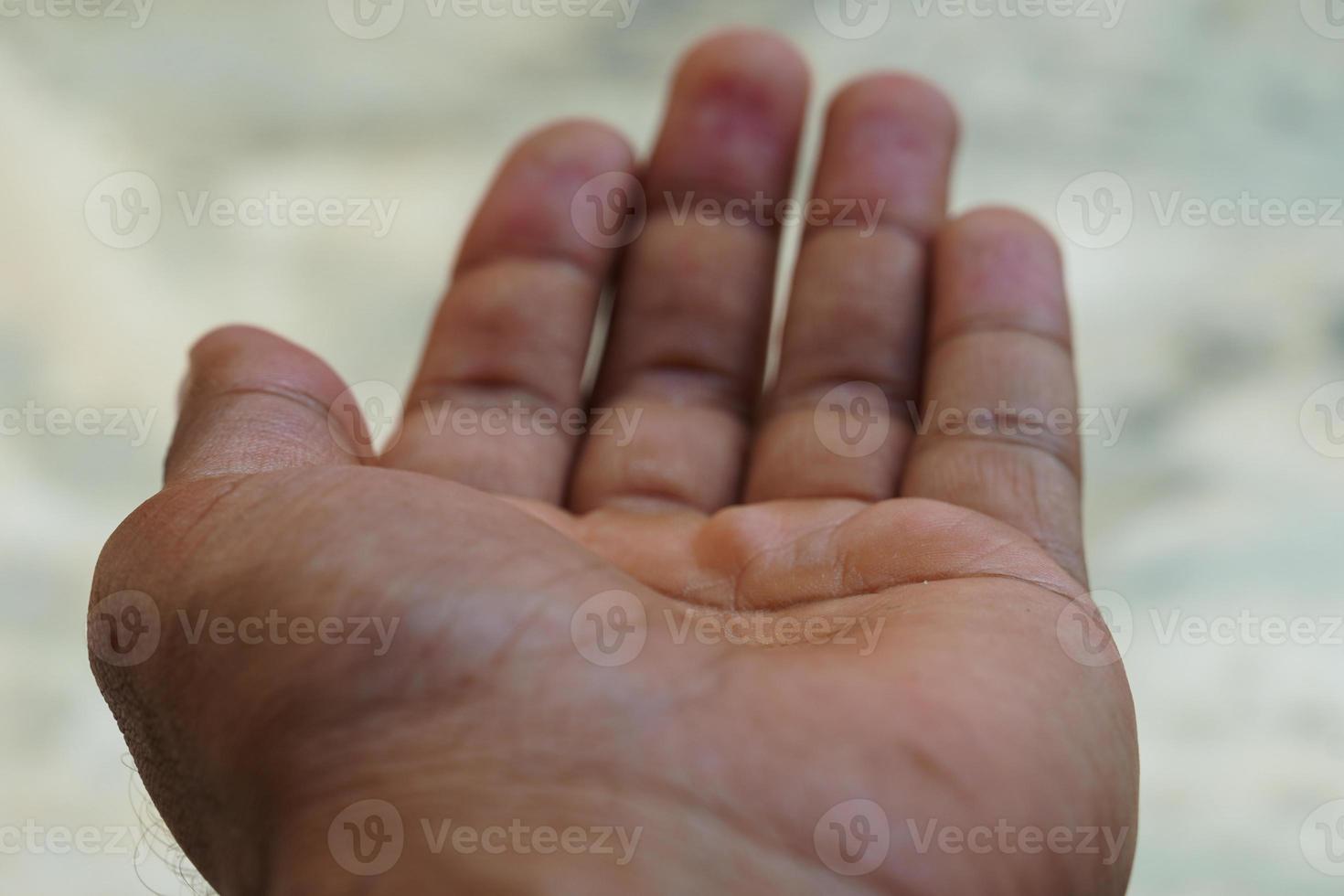 ber om pengar hand beger hand foto