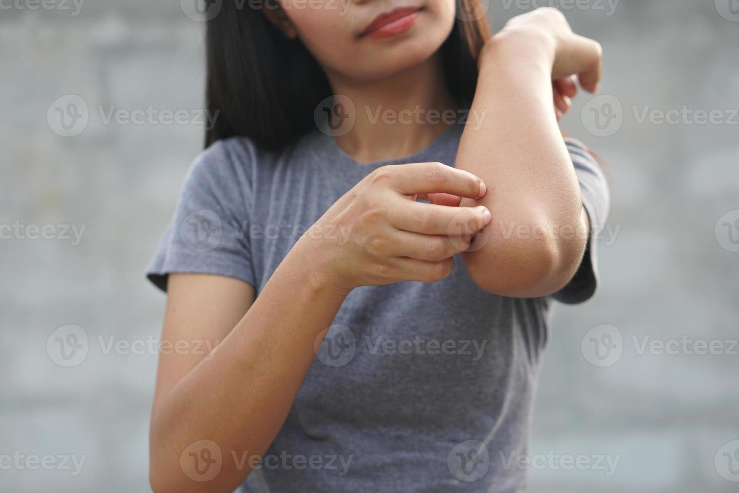 kvinna kliar arm från klåda på ljusgrå bakgrund. orsaken till kliande hud inkluderar insektsbett koncept av sjukvård hud. foto