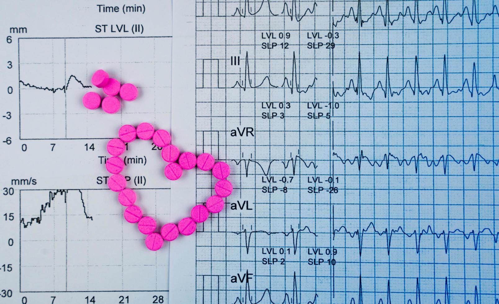 ekg eller EKG elektrokardiogram grafrapportpapper. est resultat av träningsstresstest och rosa hjärtform gjord av warfarin-tabletter. warfarin rosa tabletter för behandling av förmaksflimmer. foto