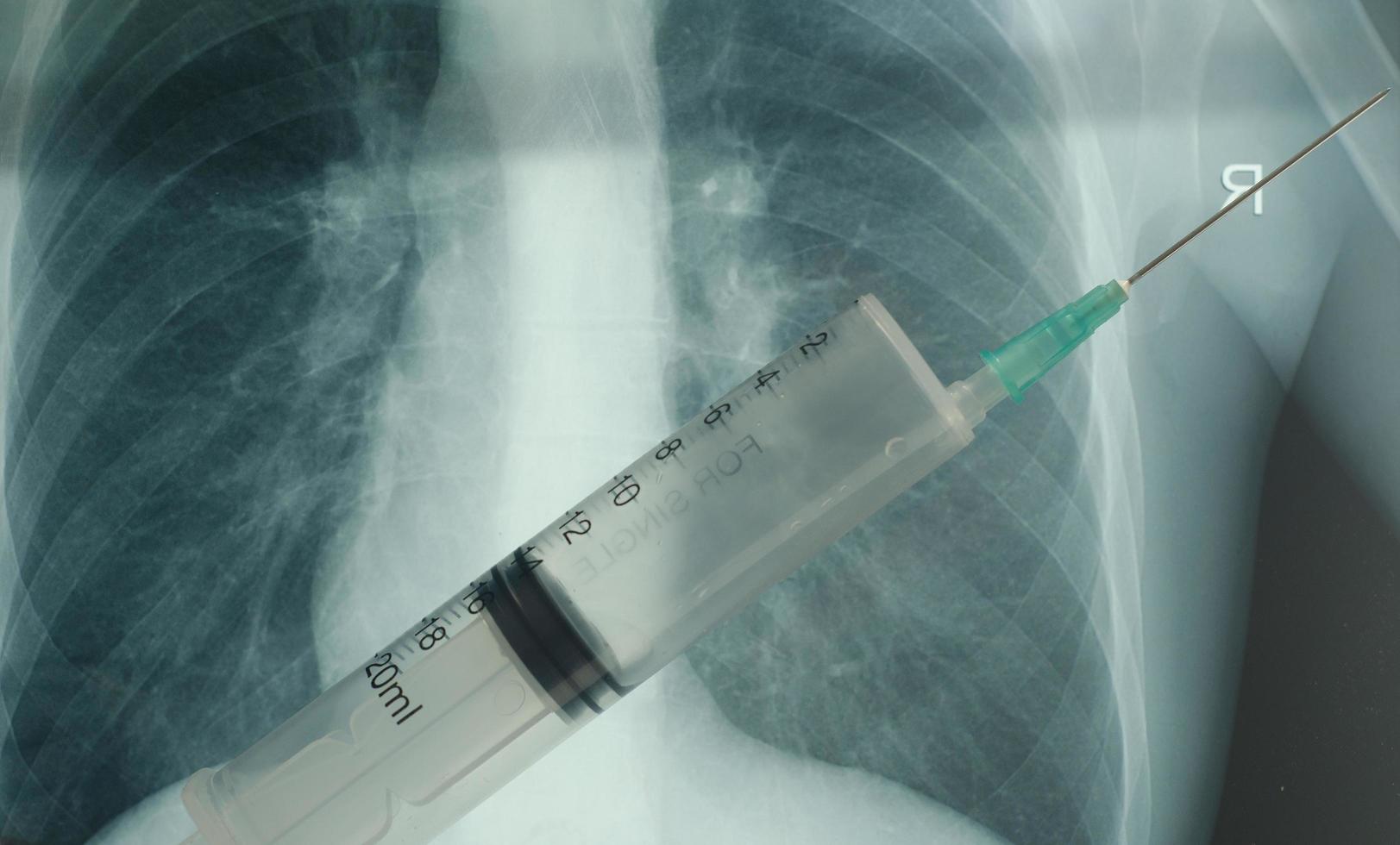 en engångsspruta för vaccination mot coronavirus på röntgenbildsbakgrund. foto