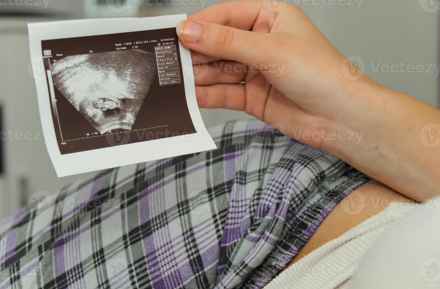 gravid kvinna tycker om att titta på ultraljudsundersökning av baby foto