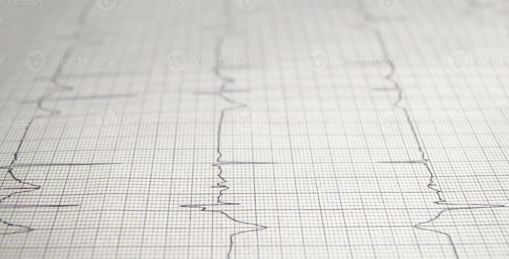 kardiogram diagram med medicinsk tabell närbild, för kirurg hjärt rekord, selektiv inriktning foto