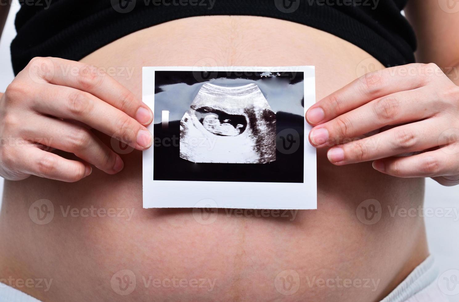gravid dam foto
