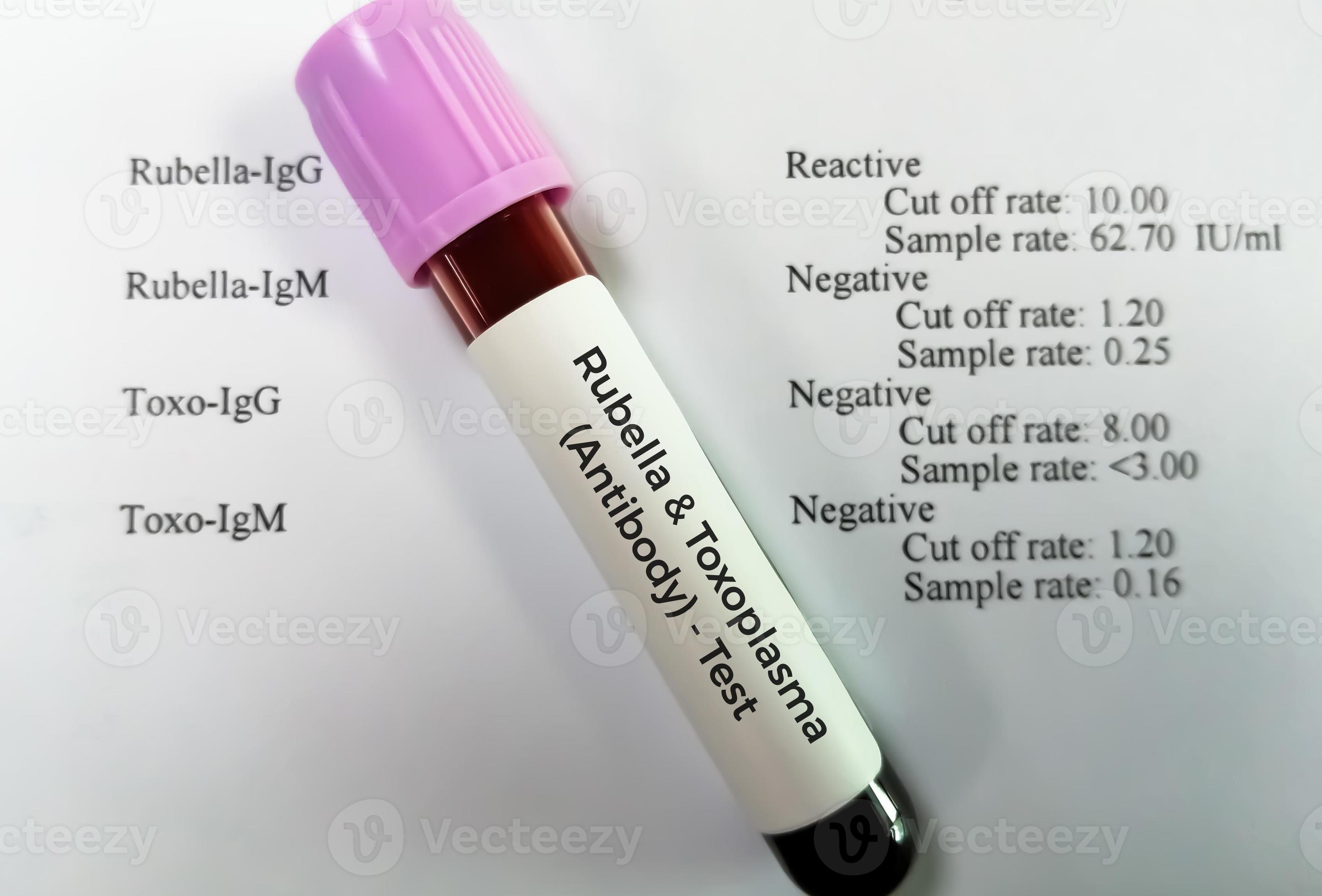 prov patient Rapportera. röda hund och toxoplasma antikroppar testning. 11107016 Stock Photo