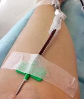 nål i blodgivarens arm under bloddonationen foto