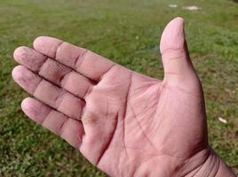 huden på handflatorna är skrynklig och våt av vatten, nedsänkt i vatten för länge. foto